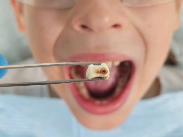 Best After-Hours Emergency Dentist in Combee Settlement, FL