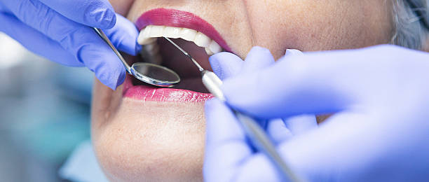 Best Emergency Broken Tooth Repair in Combee Settlement, FL